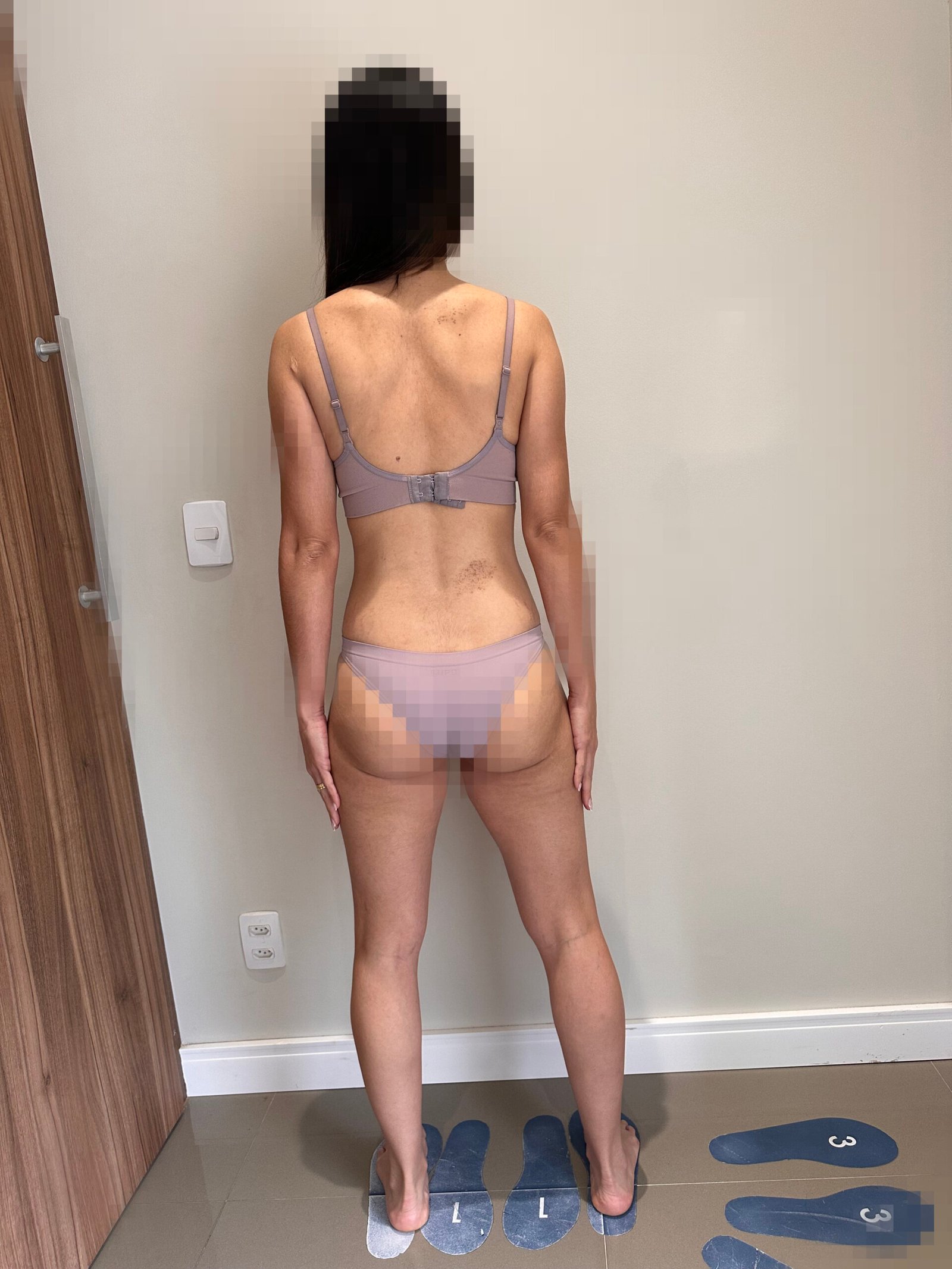 Foto depois 2