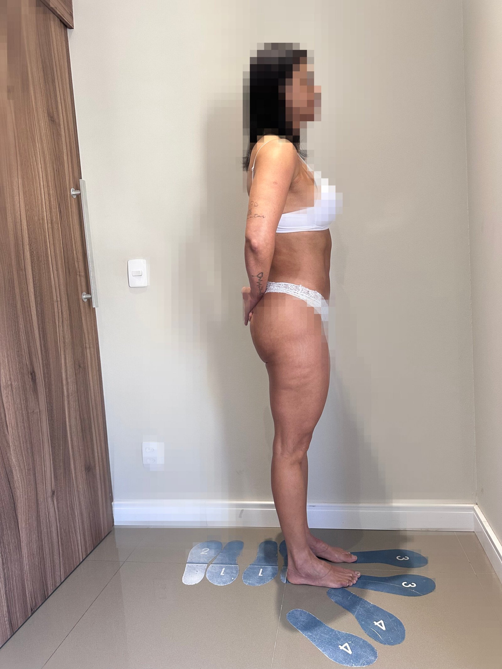 Foto depois 3