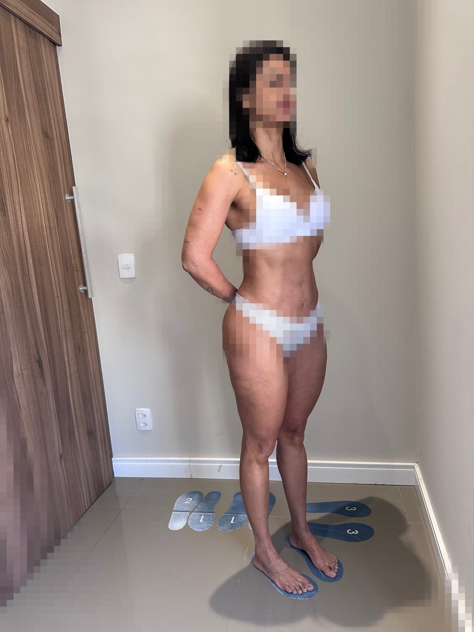 Foto depois 4