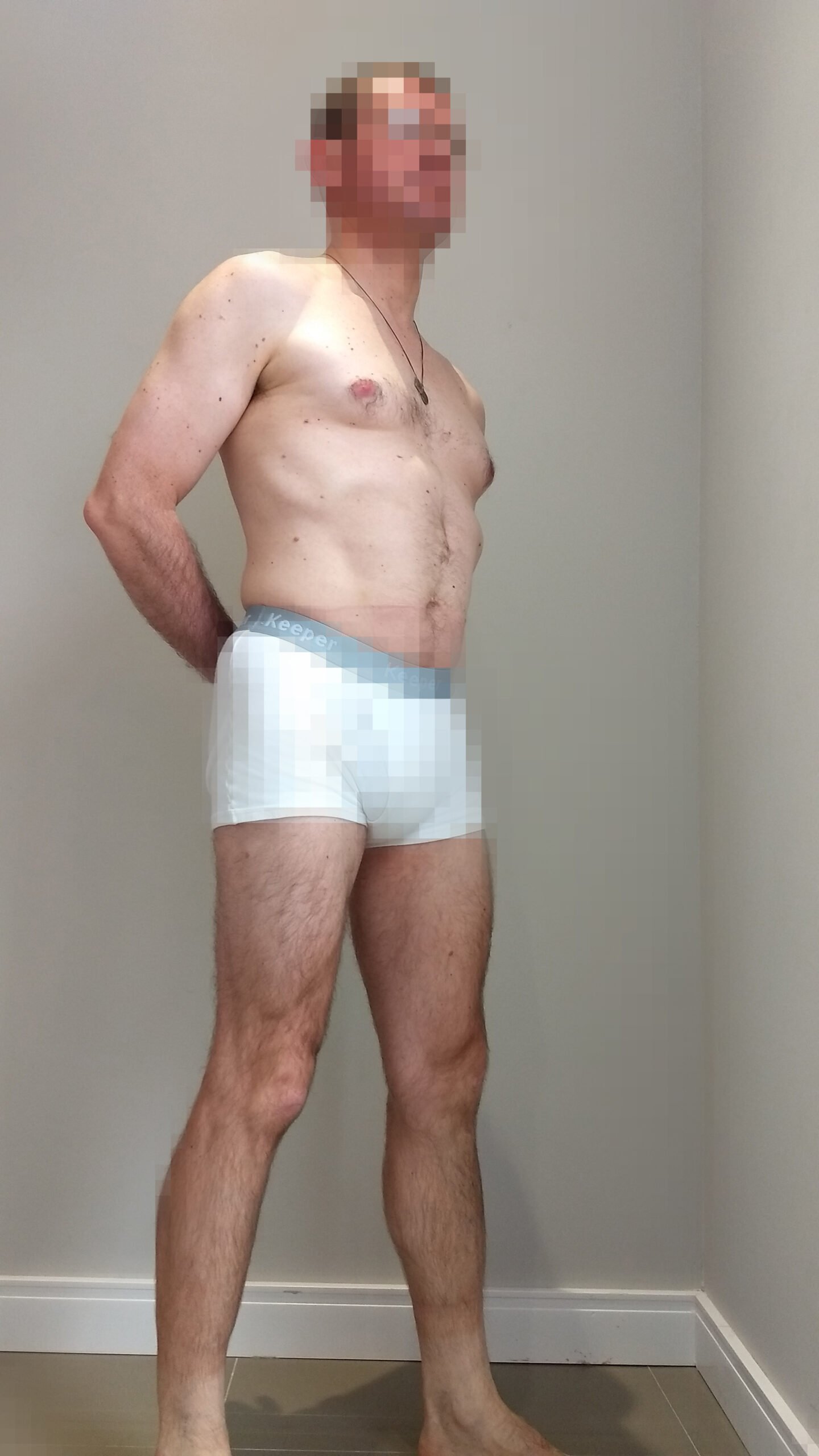 Foto depois 4